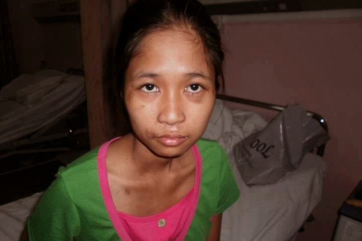 Pinay domestic worker survives jump from 3rd floor to escape abuse | GMA  News Online